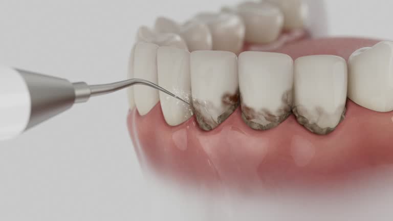 Reliable Emergency Dentist contractor in Corcoran, CA by Smile Center Dentistry